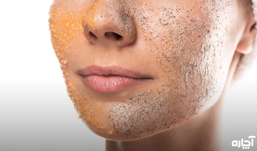 پاکسازی و لایه برداری پوست در مشهد