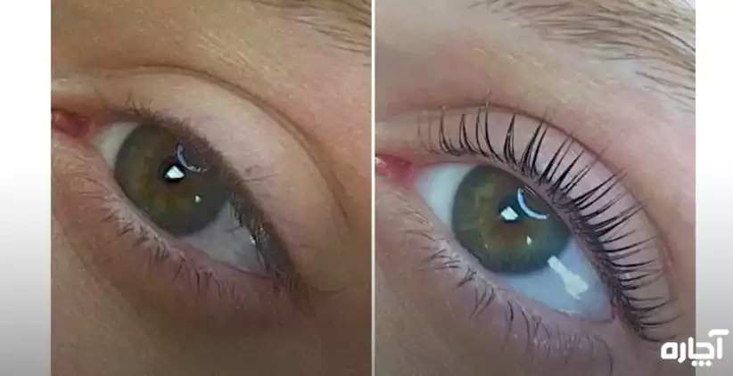 قیمت لیفت مژه