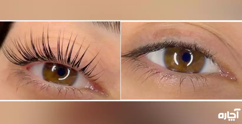 لیفت و لیمنت مژه در محل