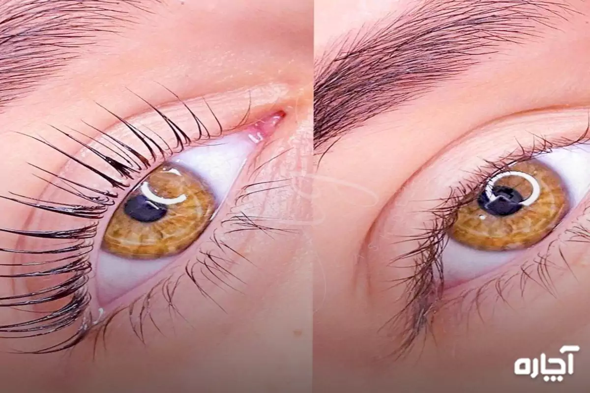 Care after eyelash lift