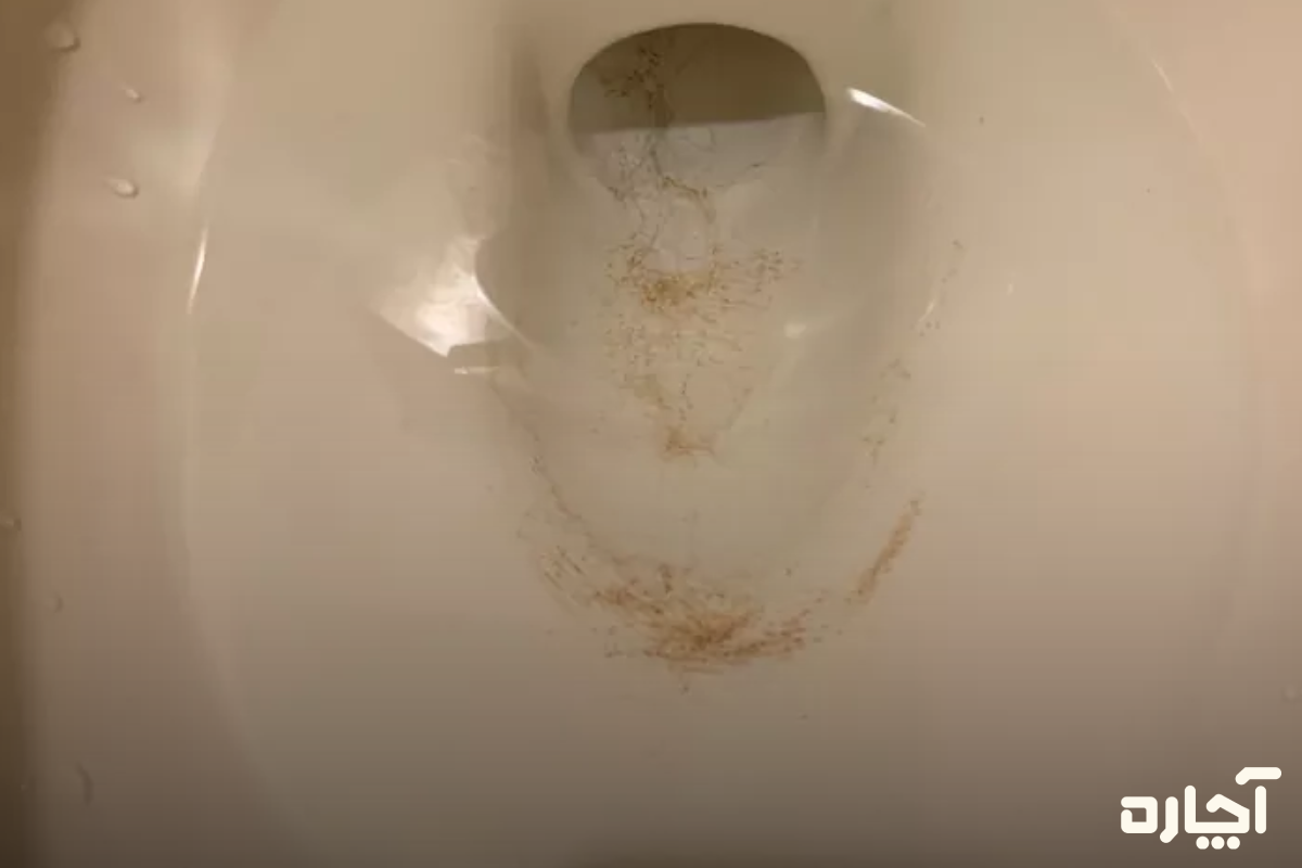 خراش لعاب توالت فرنگی