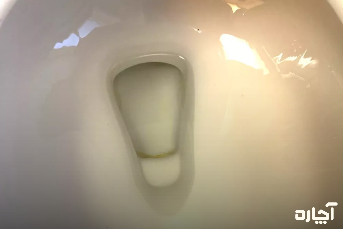 انسداد مسیر ونت دلایل بوی توالت فرنگی 