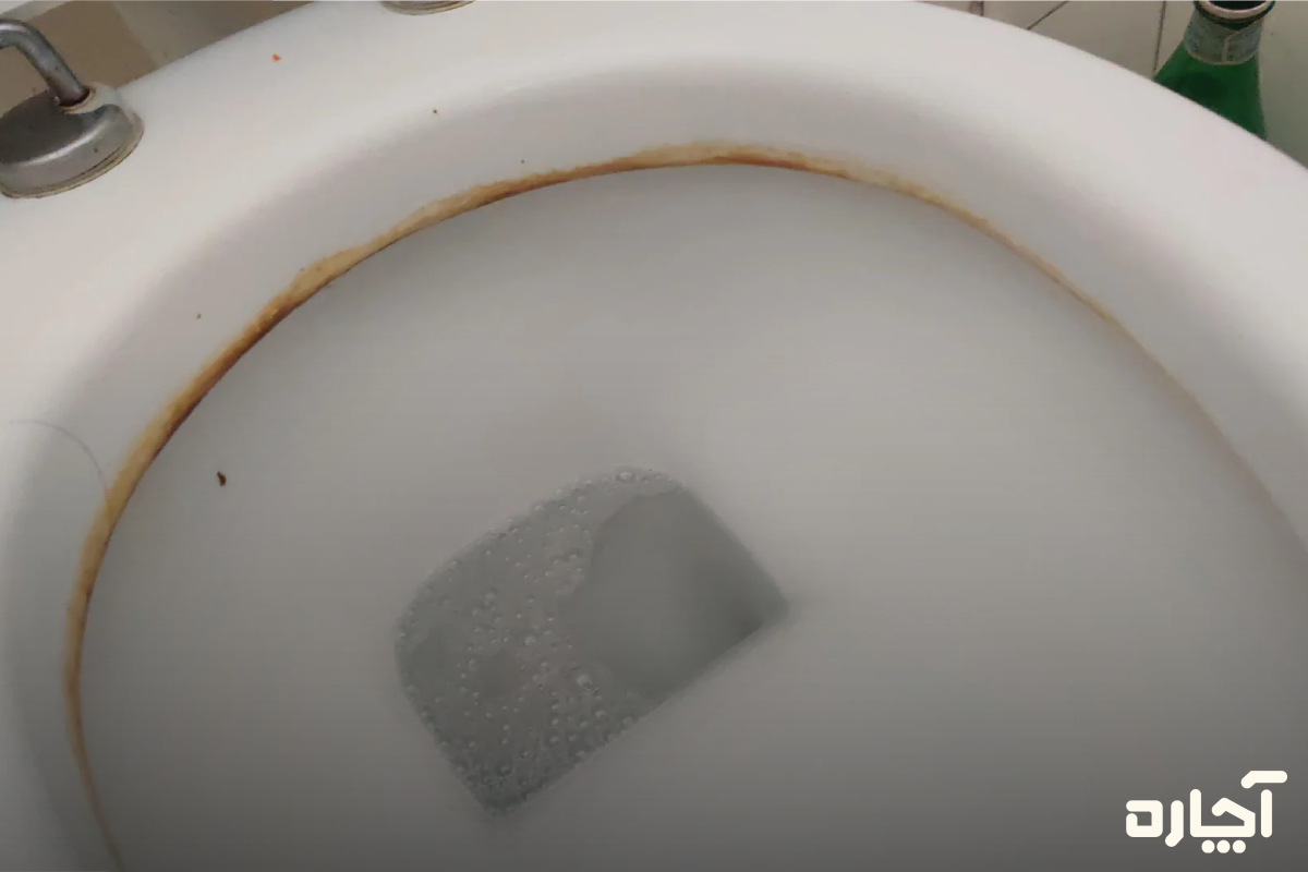 آلودگی لبه های توالت فرنگی